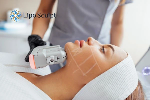 HIFU vs Botulinum Toxin: Understanding the Differences 1 HIFU vs Botox Kington What is the best option for you?