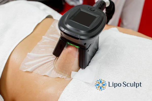 Does Fat Freezing at Home Work? DIY Devices vs Professional Cryolipolysis 1 How is professional cryolipolysis different Kington?