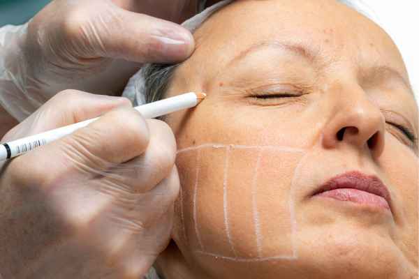 CryoPen: 5 Skin Concerns It May Be Used to Treat 4 What should you ask before having CryoPen treatment Kington?